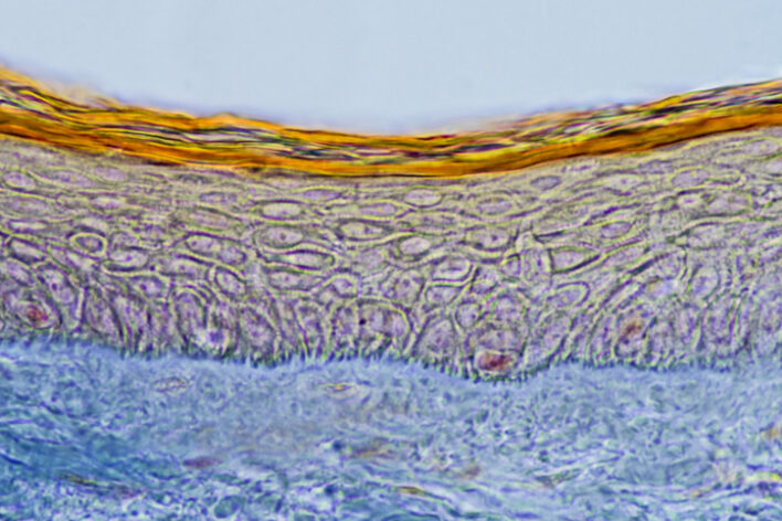 표피(Epidermis)와 진피(Dermis) ---사람 피부 100X 확대사진