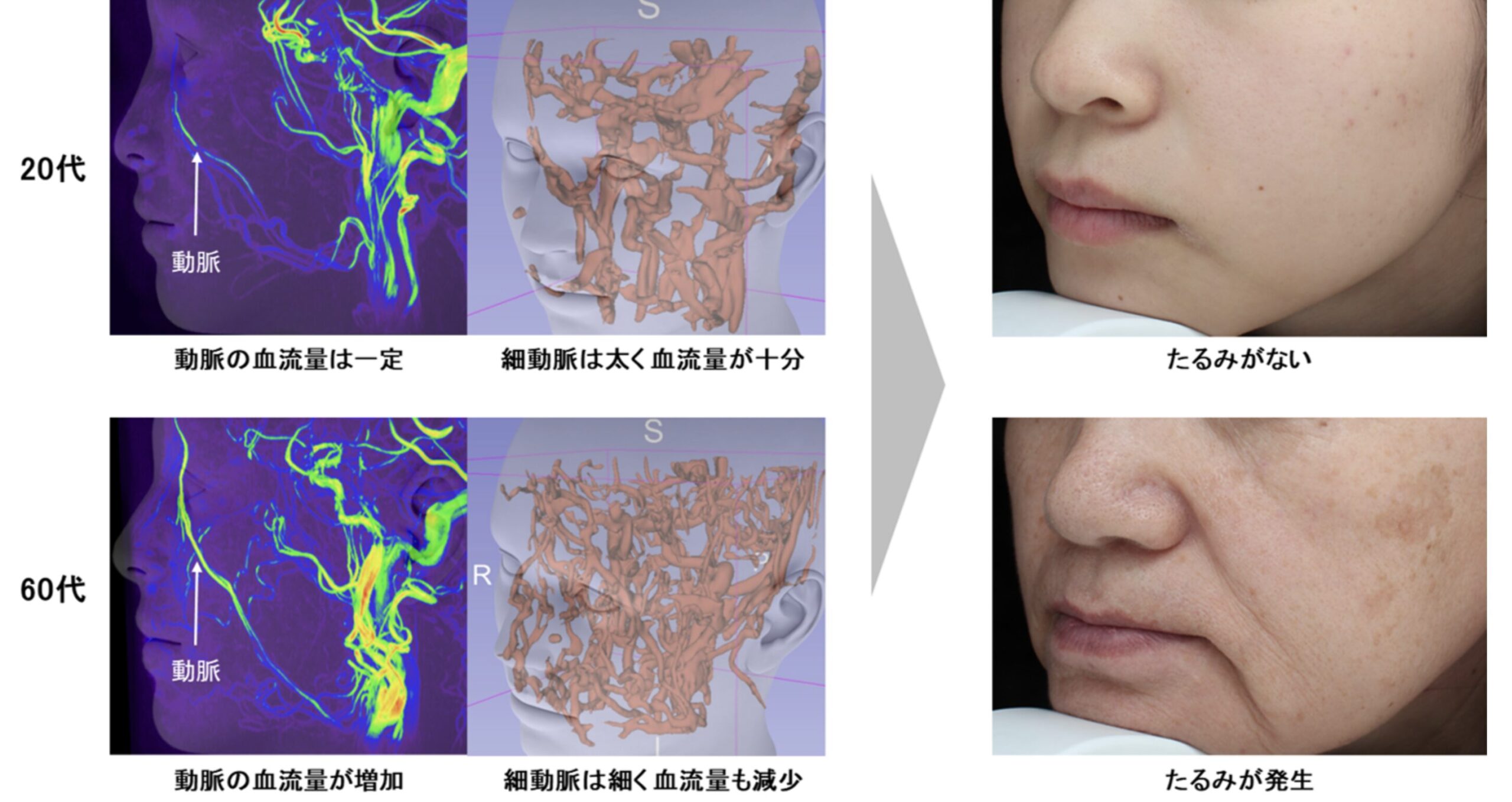 「노화」　로 인한　「피부처짐」　원인을 찾아냈다...?일본 시세이도가 밝혀낸 사실 !